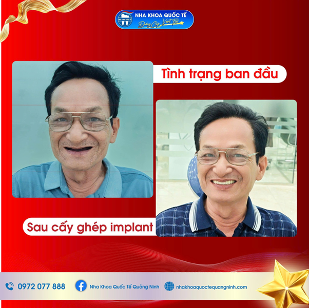 he-thong-nha-khoa-5-1757563180.png