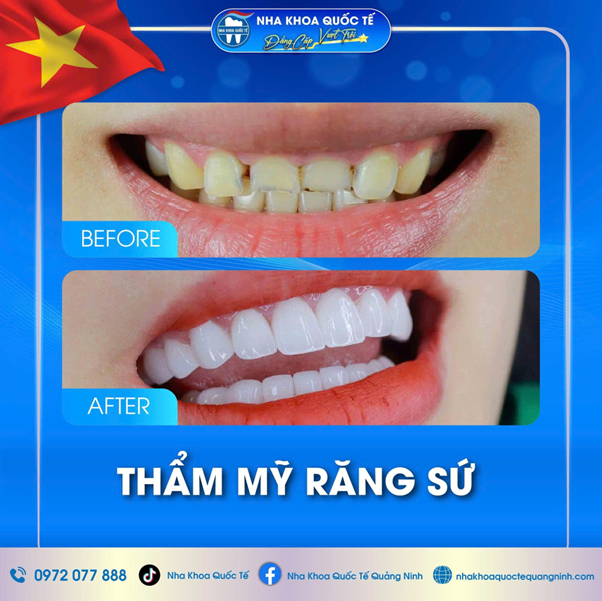 he-thong-nha-khoa-6-1757563180.png